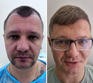 Платонова Оксана Александровна - фото до и после